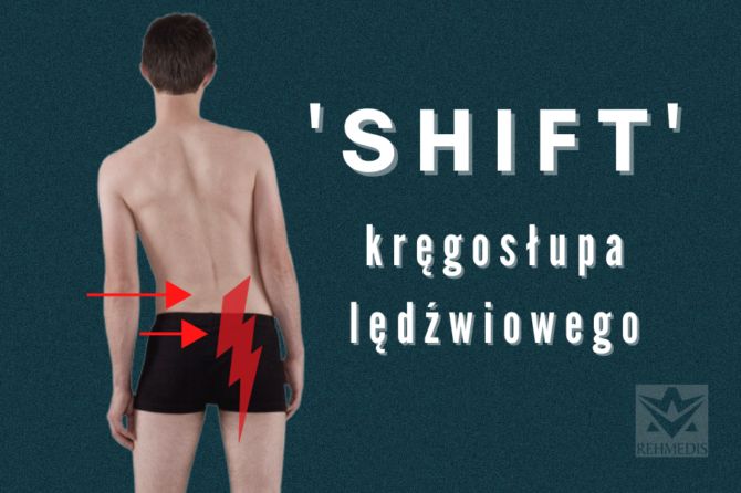 Shift kręgosłupa lędźwiowego – stan ostry i wymuszone skrzywienie boczne kręgosłupa