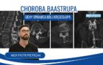 Choroba Baastrupa – Cichy sprawca bólu kręgosłup